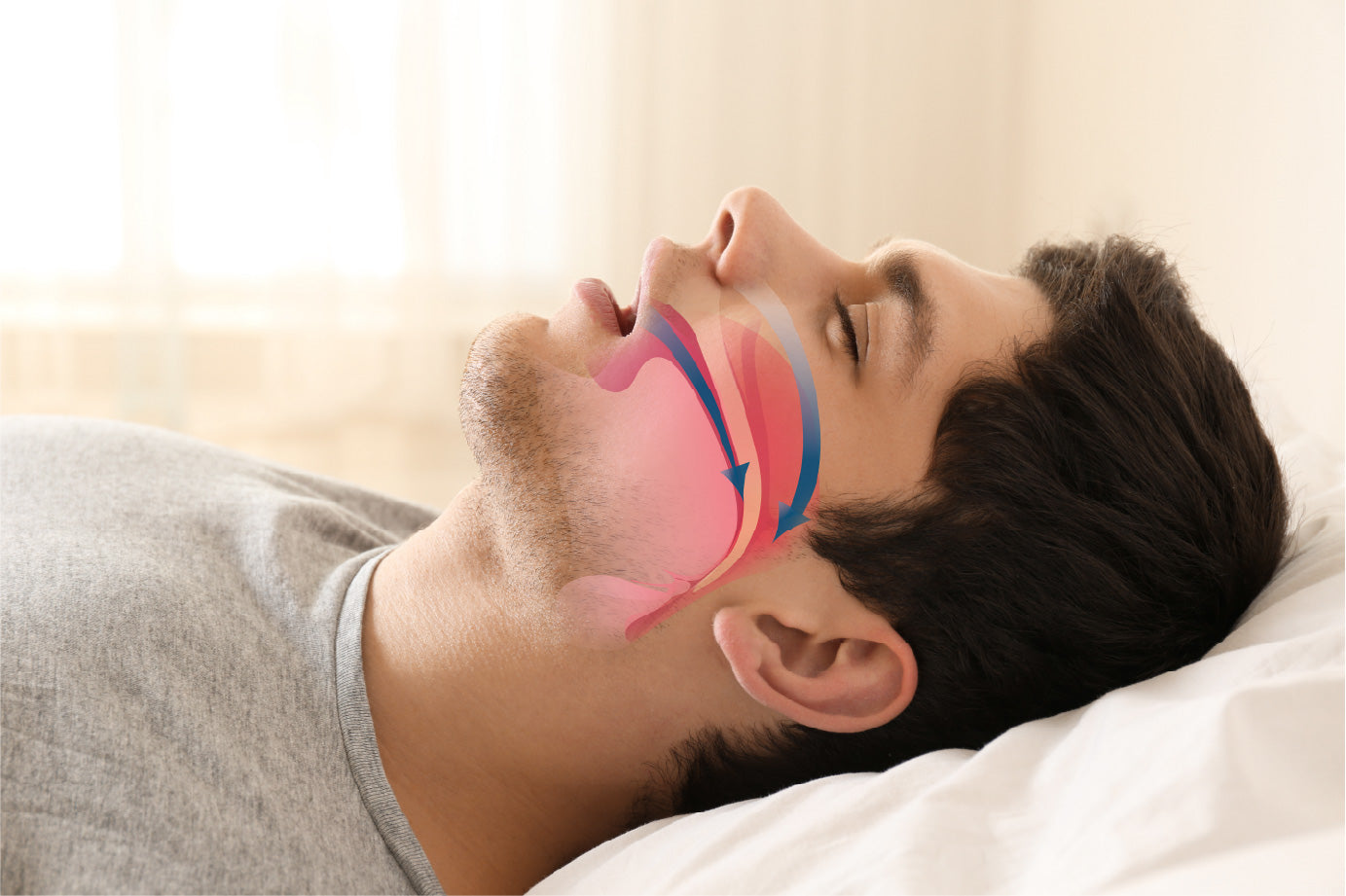 Do Nasal Strips Help with Snoring? The Science Behind Better Sleep
